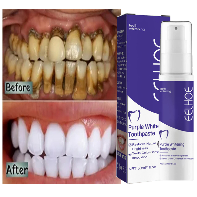 Teeth Whitening In Korea - Dentifrice blanchissant pour le nettoyage des