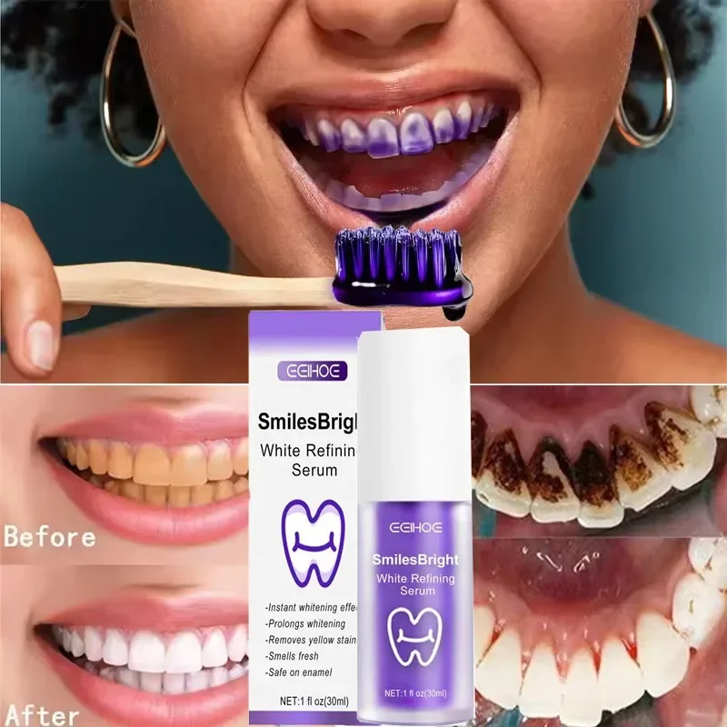Nettoyage des dents dentifrice - Teeth Whitening In Korea avis et prix