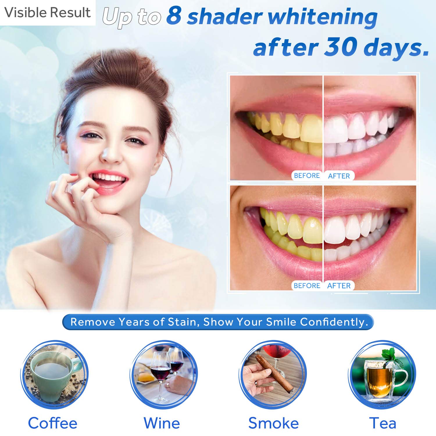 Gel de blanchiment des dents r - Teeth Whitening For Trays avis et prix