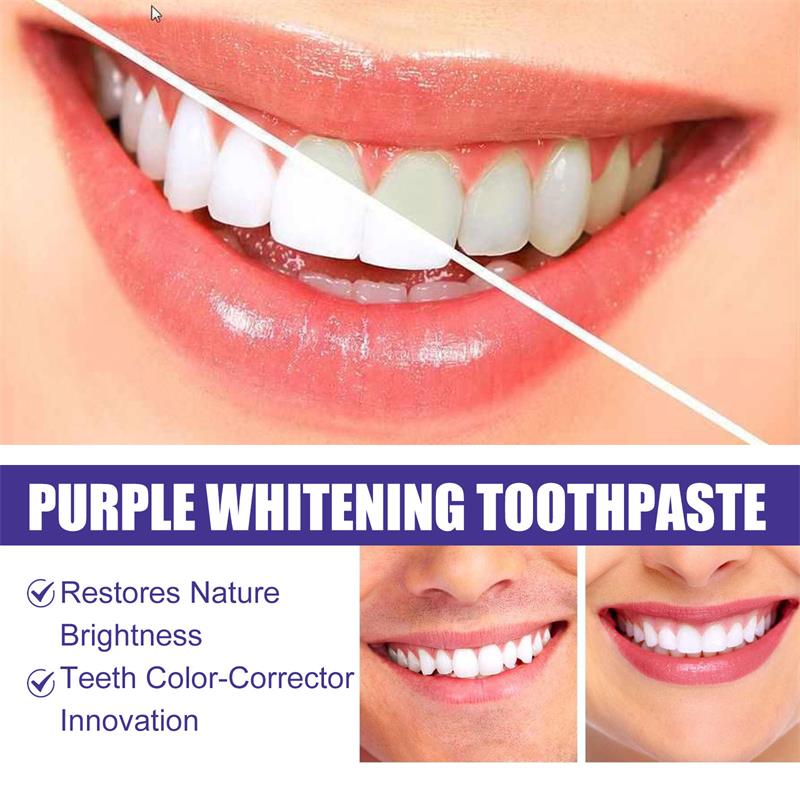 Dentifrice blanchissant pour l - Teeth Whitening In Korea avis et prix