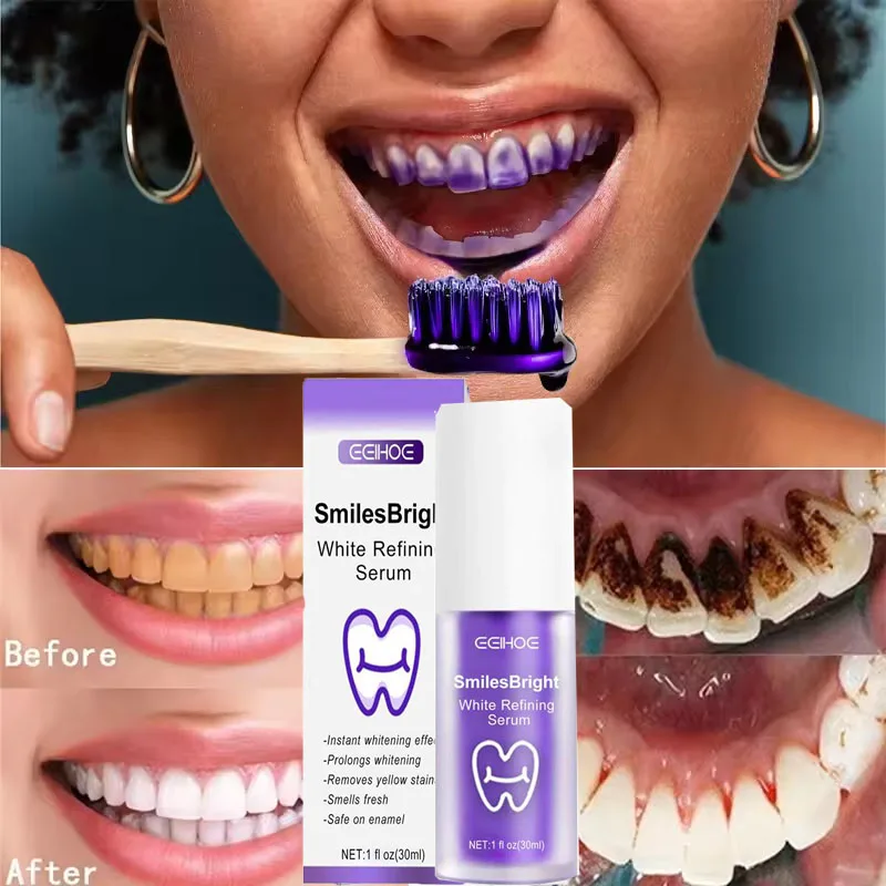 Nettoyage des dents dentifrice - Teeth Whitening In Korea avis et prix