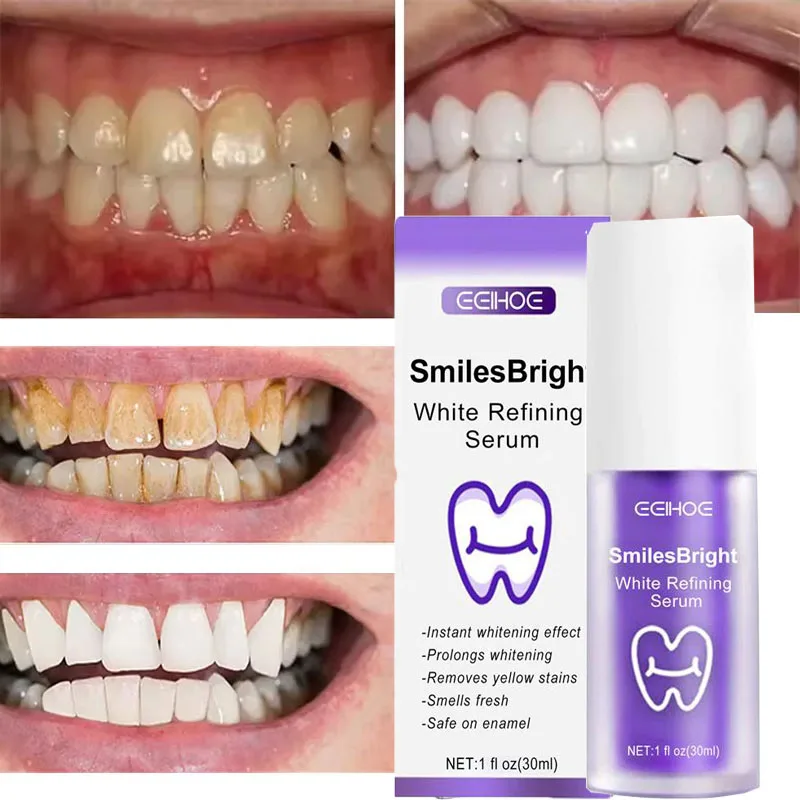 Nettoyage des dents dentifrice - Teeth Whitening In Korea avis et prix