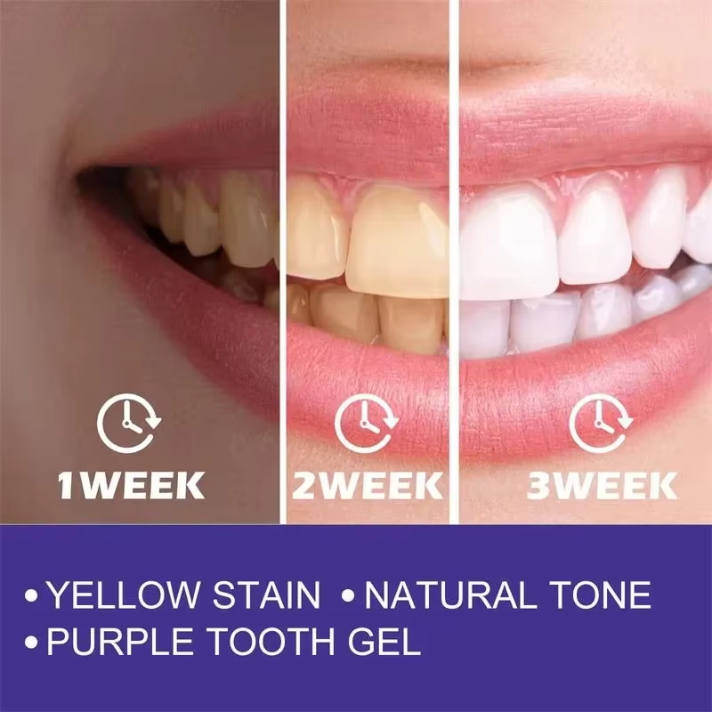 Nettoyage des dents dentifrice - Teeth Whitening In Korea avis et prix